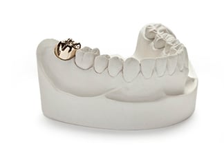 Materials Used In Making Dental Crown And Bridges Materials Used In Making Dental Crown And Bridges